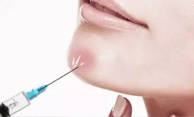 注射玻尿酸和外用玻尿酸的区别是什么