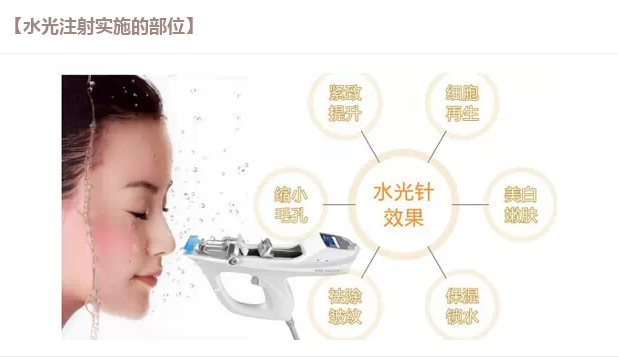 注射水光针的效果怎么样