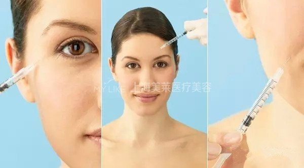 玻尿酸注射过量会怎么样？